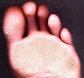 Plantas de píes son óptimas para identificación en... 6 Cd1VWsQWoAAnhkH